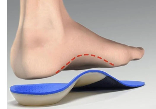 What Are Orthotic Insoles? Types, Benefits, and How They Work