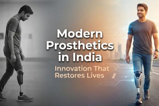 Modern Prosthetic Technology Available in India: Transforming Lives Through Innovation