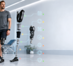 How Often Should You Replace Different Prosthetic Components