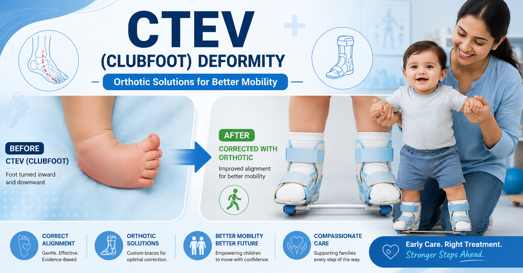 CTEV (Clubfoot) Deformity and Its Orthotic Solutions: A Complete Guide for Parents and Patients