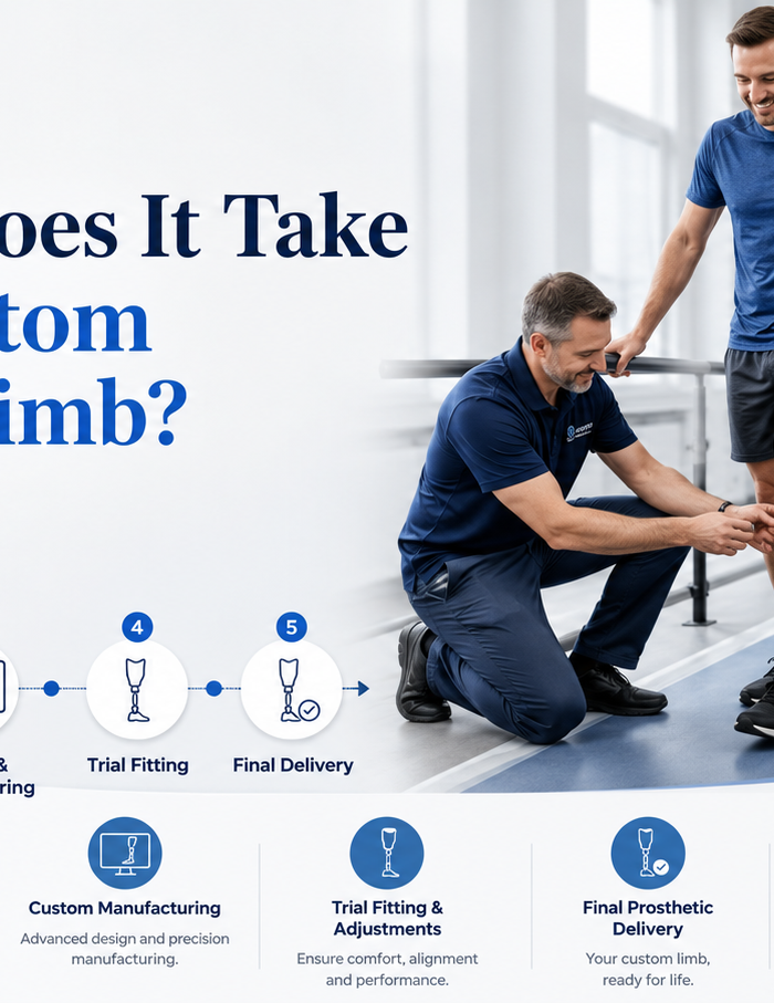 How Long Does It Take to Get a Custom Prosthetic Limb