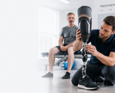 How Long Does a Prosthetic Leg Last?