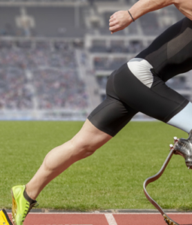 Sports and Prosthetics: Inspiring Stories of Athletes Who Overcame Challenges
