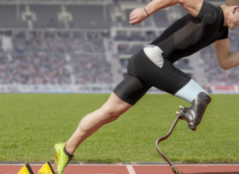 Sports and Prosthetics: Inspiring Stories of Athletes Who Overcame Challenges
