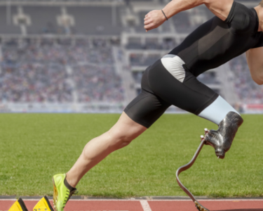 Sports and Prosthetics: Inspiring Stories of Athletes Who Overcame Challenges