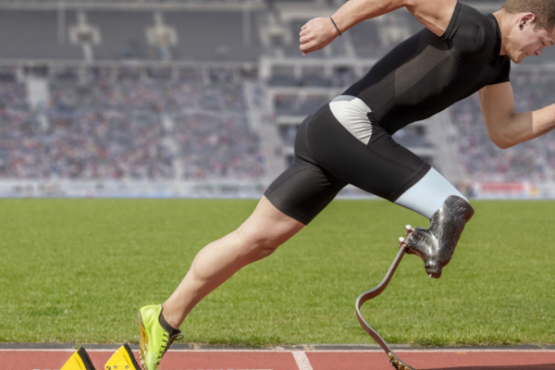 Sports and Prosthetics: Inspiring Stories of Athletes Who Overcame Challenges