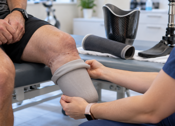 Understanding Prosthetic Liners, Sockets, and Suspension Systems