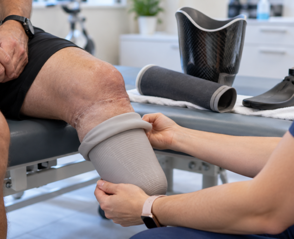 Understanding Prosthetic Liners, Sockets, and Suspension Systems